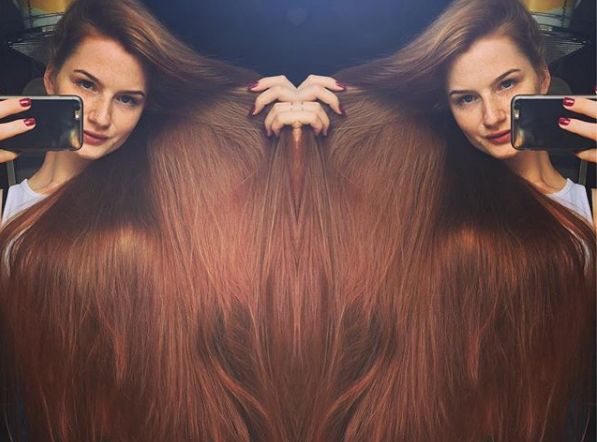 从“秃头症”到长发公主,听起来有点不可思议,但这是现实