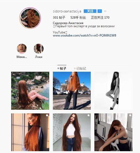 从“秃头症”到长发公主,听起来有点不可思议,但这是现实