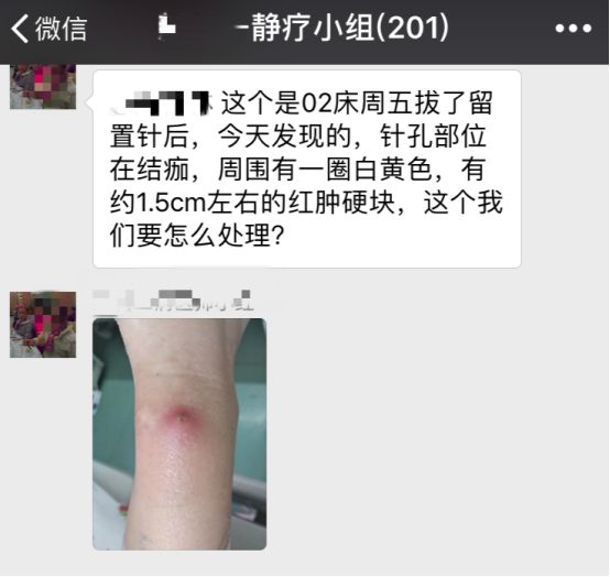 留置针细菌感染了会怎么样,留置针拔了漏药水