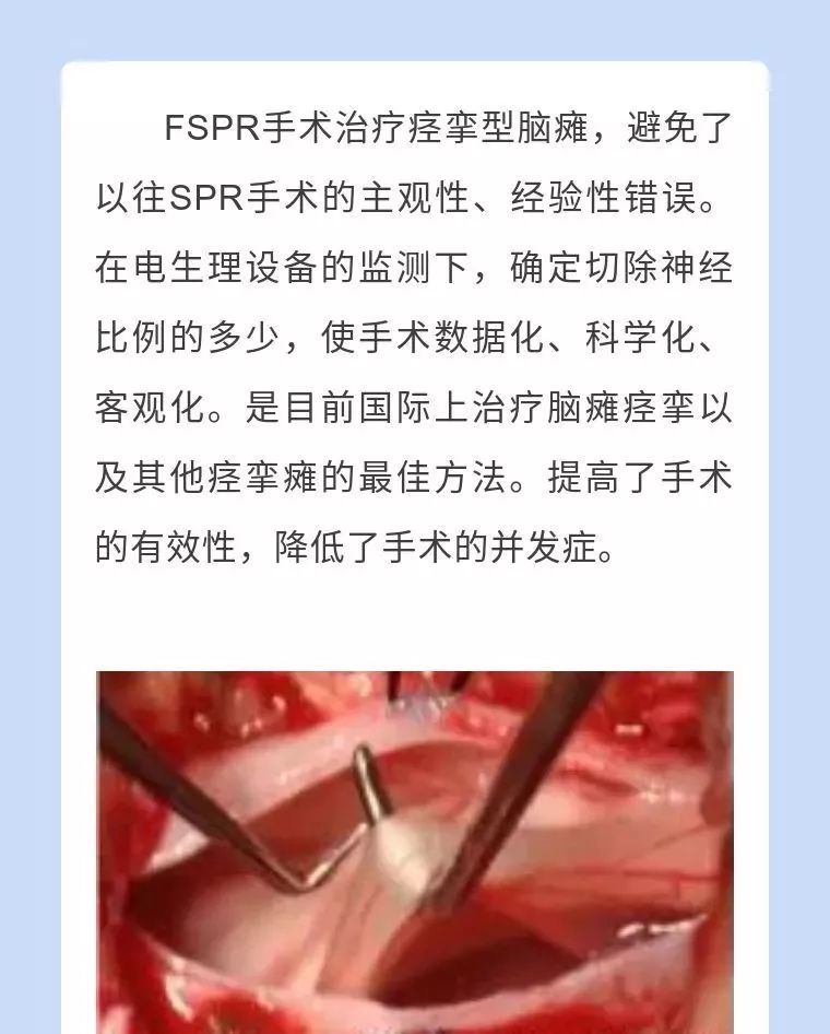 四川脑瘫康复方法,脑瘫男童康复中心