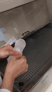 刚出生就要打石膏？硬核医生手工打造矫形器治疗足外翻