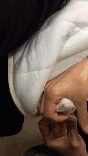 刚出生就要打石膏?硬核医生手工打造矫形器治疗足外翻