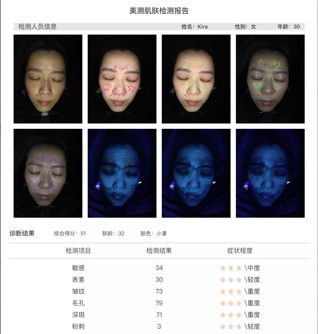 小茂肌诊室到底有多强,小茂肌诊室皮肤状态