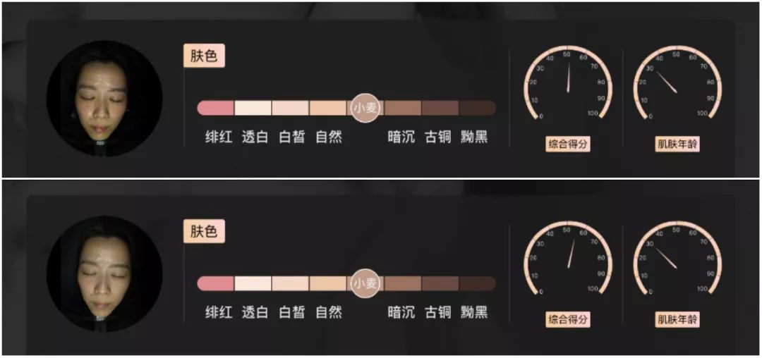 小茂肌诊室到底有多强,小茂肌诊室皮肤状态