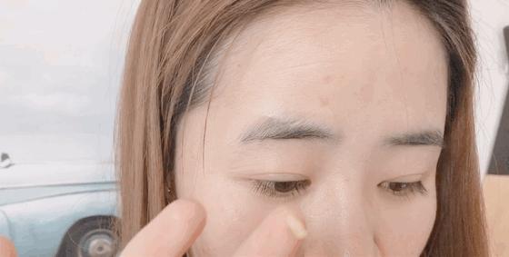 晒斑痘印去除土方法,5个祛斑小妙招淡化晒斑雀斑痘印