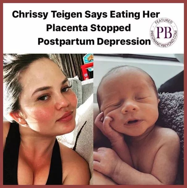 张雨绮猪油抹脸,张雨绮猪油膏