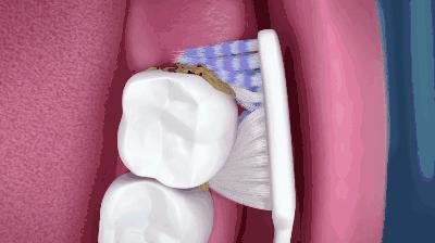 记忆手柄牙刷，刷新想象！1支=5支普通牙刷+1瓶漱口水+1瓶口香糖