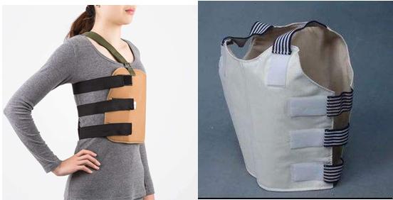 支具代替石膏有用吗,治疗骨折用石膏的优点