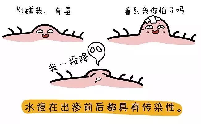 孩子水痘大人预防,水痘高发期战痘秘籍学起来