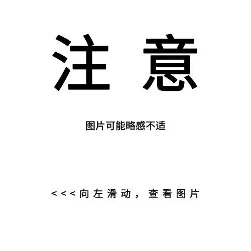 痒痒痒！疥螨会在皮肤内挖掘隧道