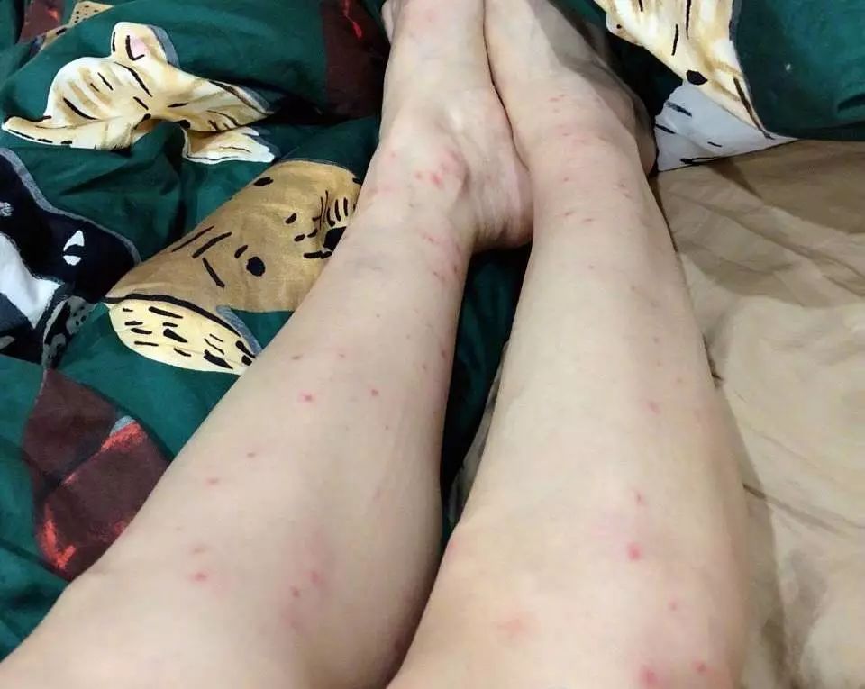 蚊子驱蚊驱虫,杀虫剂对蚊子有效又安全