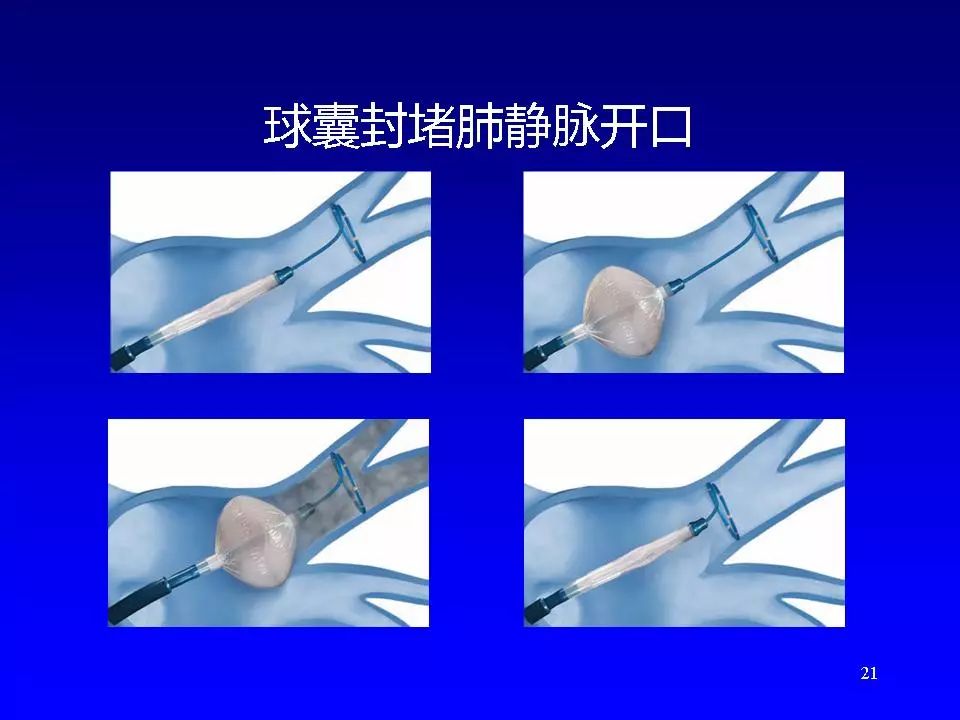 方丕华医生在哪个医院出诊,阜外方丕华出诊时间