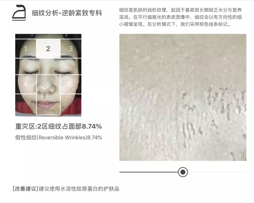 灏忚寕鑲岃瘖瀹よˉ姘村悧,灏忚寕鑲岃瘖瀹ゅ埌搴曟湁澶氬己