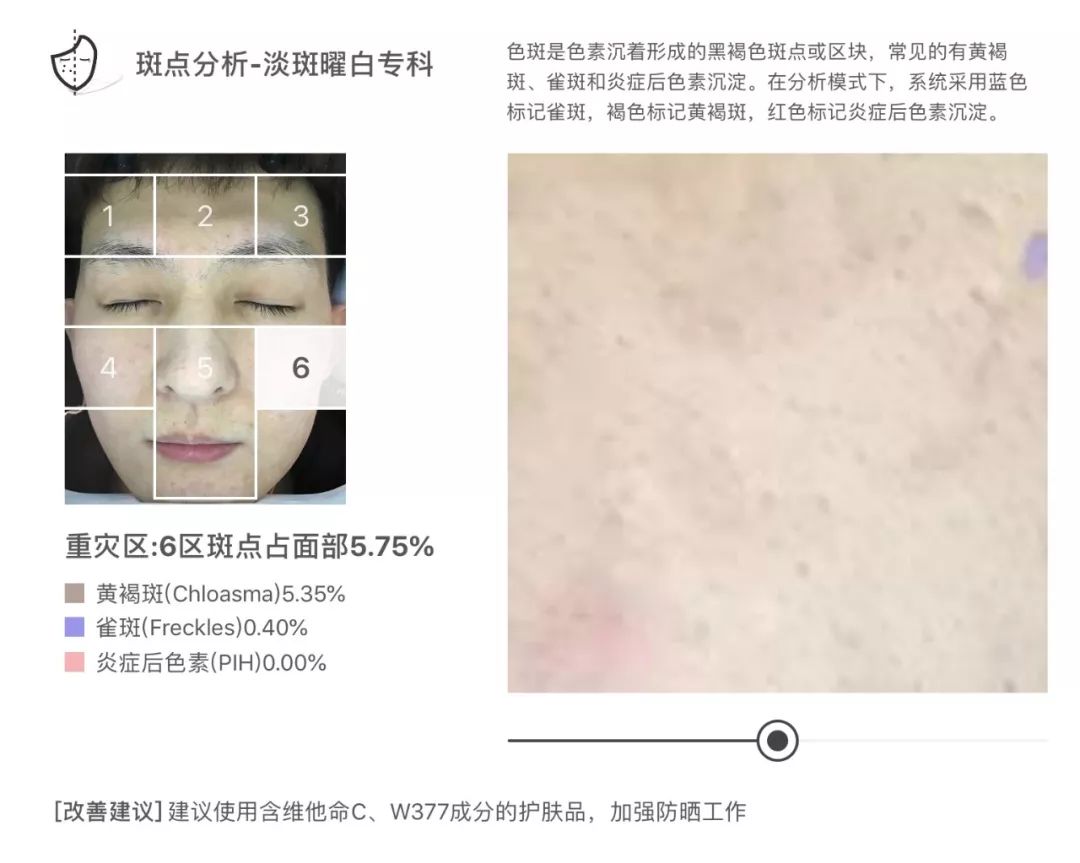 灏忚寕鑲岃瘖瀹ゅ埌搴曟湁澶氬己,灏忚寕鑲岃瘖瀹よˉ姘村悧