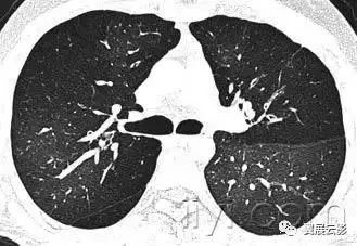胸部解剖及常见疾病影像表现,胸部影像学基础知识