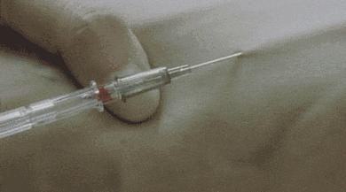 终于知道胳膊上的疤痕是怎么来的,终于知道为什么手臂上有疤了