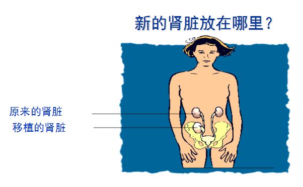 科普肾脏,医学科普出汗和肾脏关系