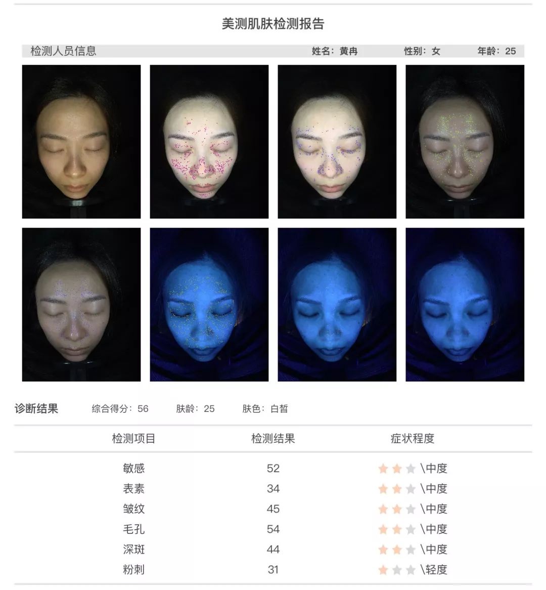 小茂肌诊室∣为什么拼命补水好多年,皮肤还是没变好?