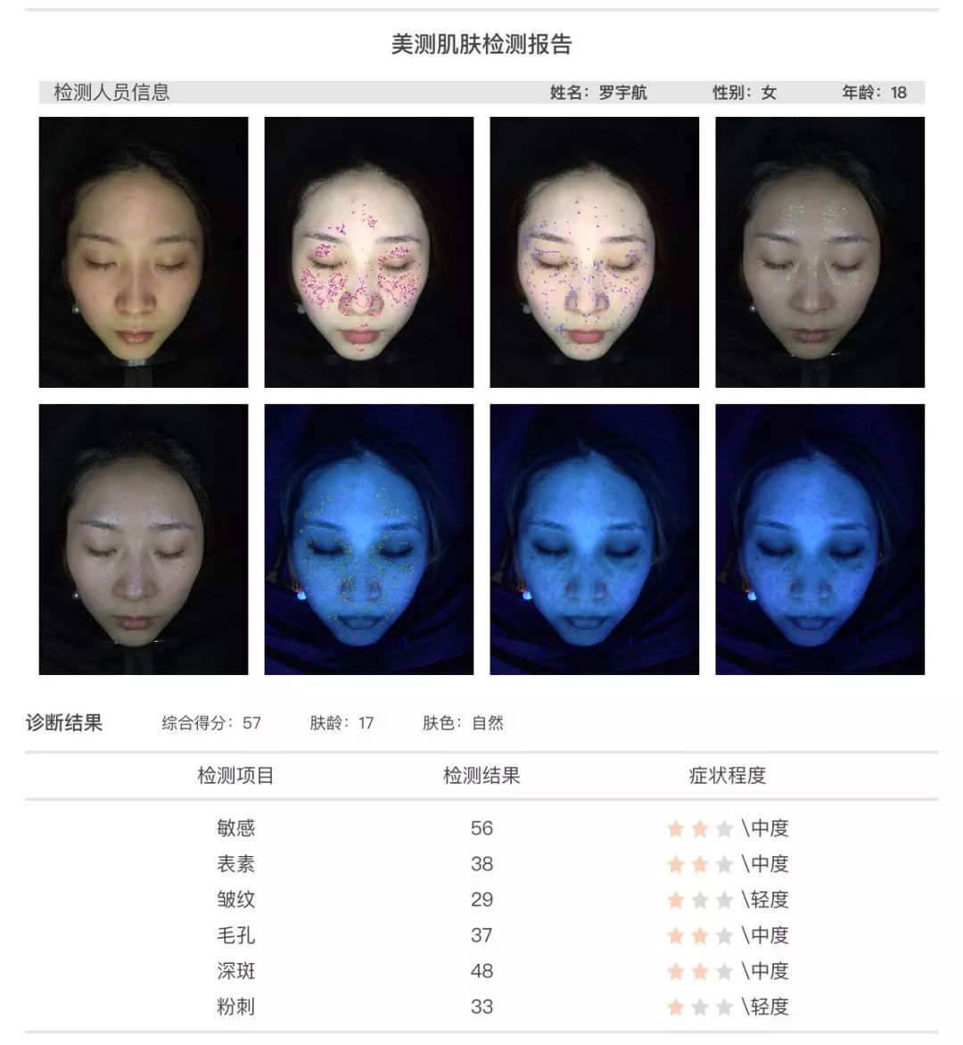 小茂肌诊室∣为什么拼命补水好多年,皮肤还是没变好?