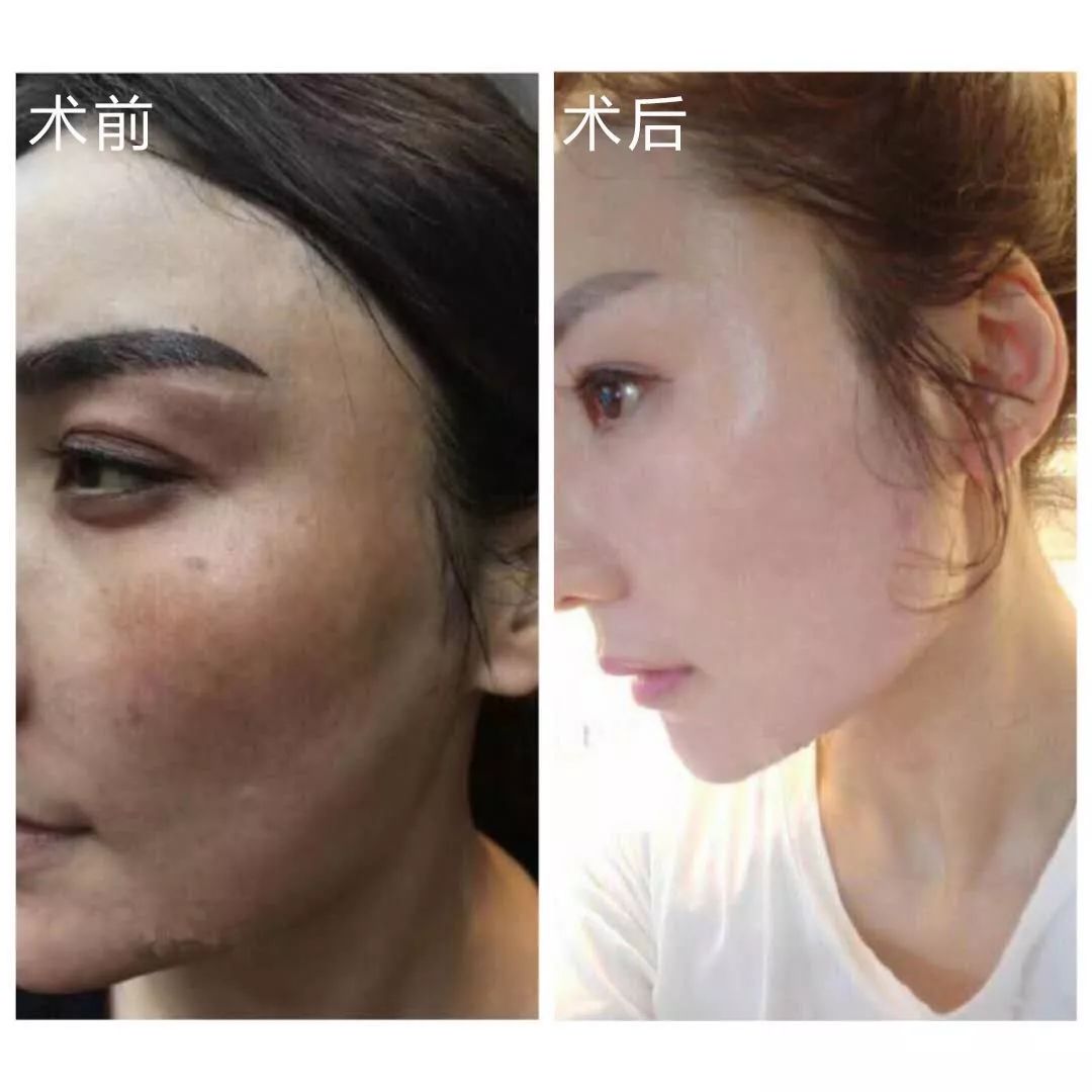 怀孕变丑真正原因,什么时候怀孕变难看