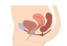 生孩子到底怎么用力才正确,生娃前要怎么放松