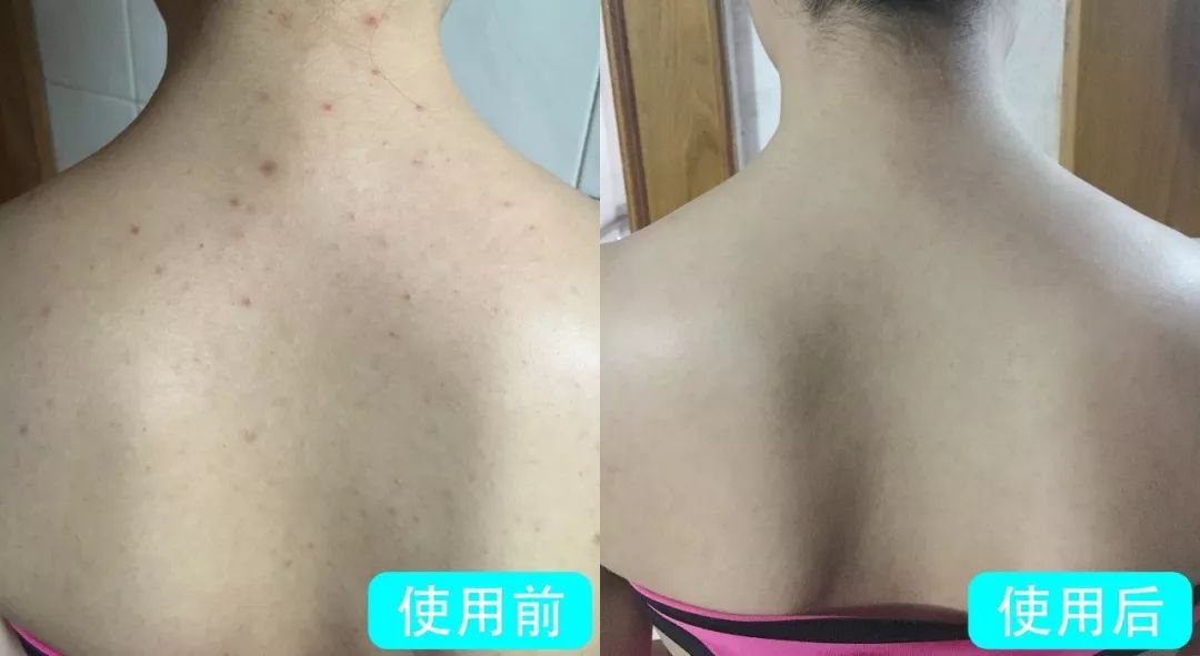 法国Lérane草本净螨贴，萃取天然植物，除螨更安心