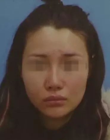 花四万元整形鼻子成了S型?