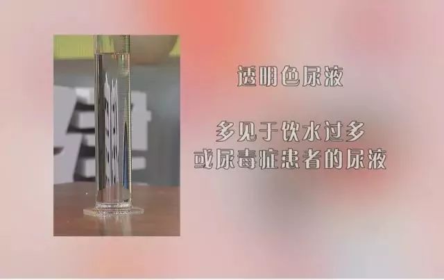 有一种尿的颜色或是癌症信号，赶紧检查一下你尿液的颜色！