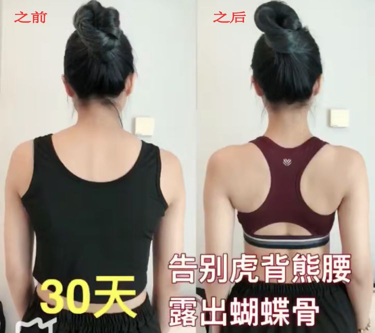 有什么方法可以改善含胸驼背,含胸驼背改善的方法