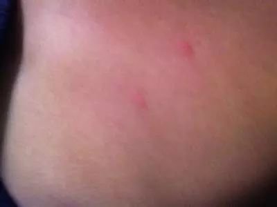 洗澡搓出泥的正确方法,洗澡搓下来的泥是什么