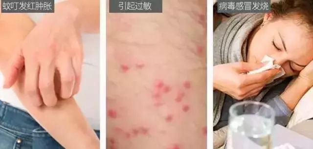 日本蚊子驱蚊神器,夏天灭蚊必备好物