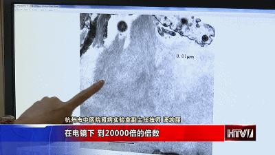 对肾病最有研究的医院是哪家,最牛的肾病医院