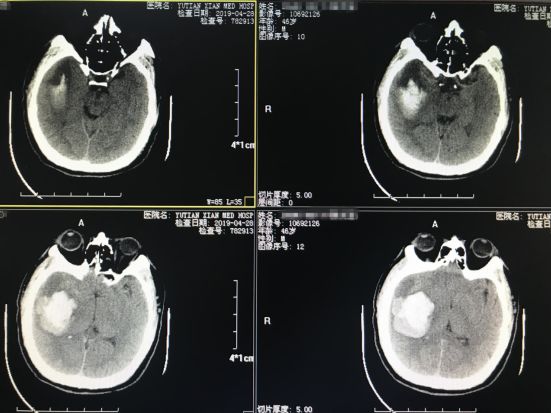 打开一扇“小窗”，还您身体健康！