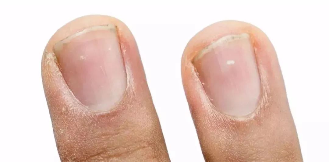 医生谈小孩挑食危害视频,儿科医生孩子挑食