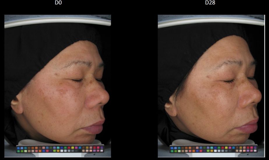 疯狂美白,这四种美白方法千万别乱试