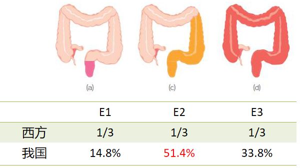 溃疡性结肠炎的诊疗过程医生笔记,溃疡性结肠炎协和