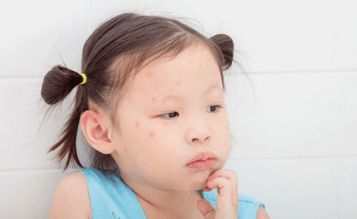 屋里放一点东西可以驱蚊子,家里放什么蚊子跑光光