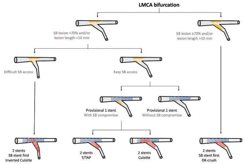 EHJ综述：左主干病变治疗更新，最新欧美指南将如何推荐？｜热点聚焦