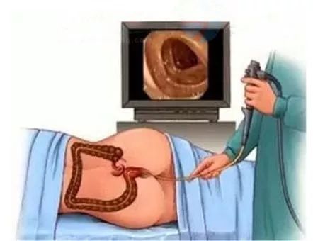 海南省人民医院消化内镜室,海口市人民医院胃镜检查怎么做