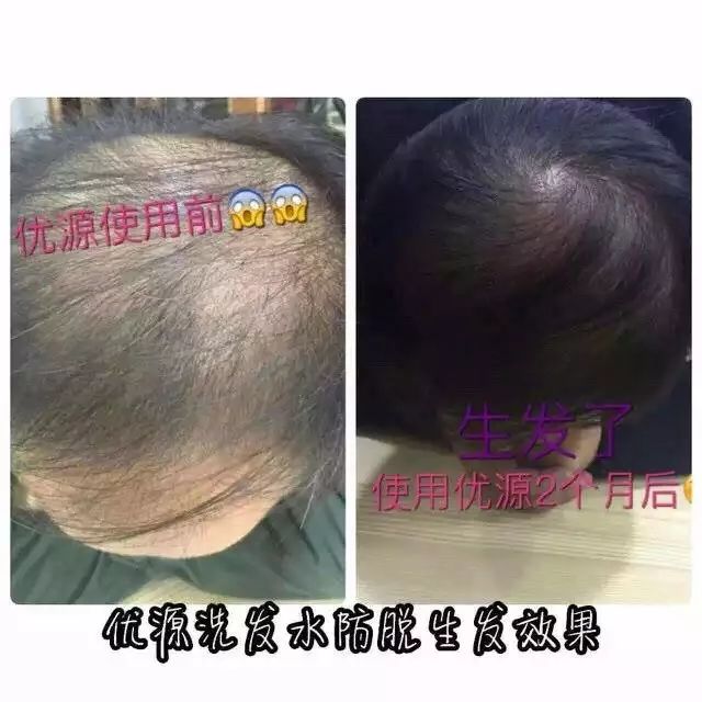 老姜洗发水解决头皮问题,一瓶生姜防脱洗发水