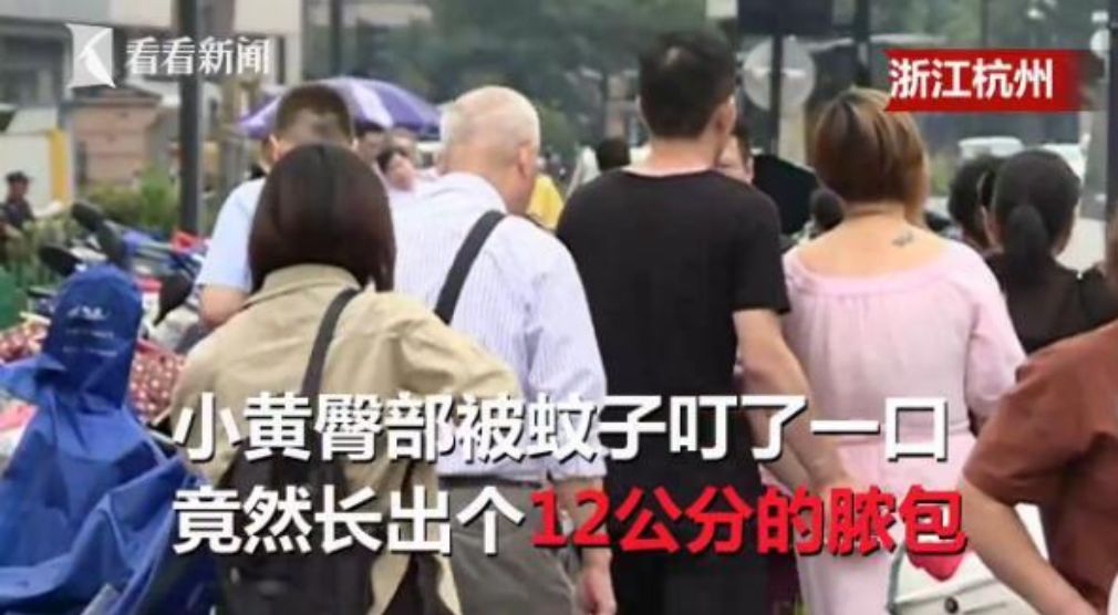 泰国蚊子叮咬止痒膏成人,蚊虫叮咬最管用泰国药膏