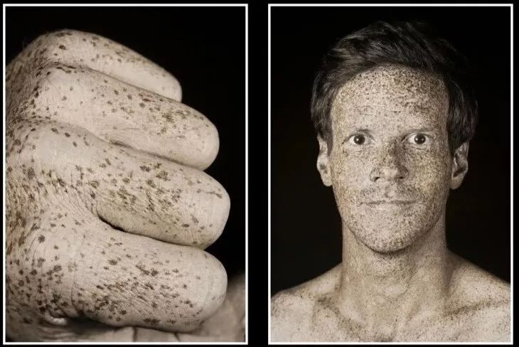 这个举动竟决定你的颜值！一组图震惊所有人：你的皮肤比想象可怕！