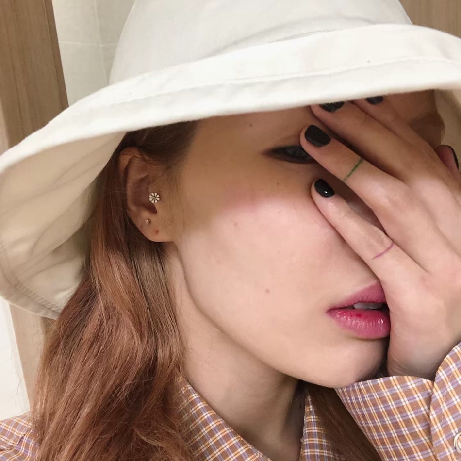 好疼！泫雅清州大学表演不慎摔倒晒受伤照颧骨磕青