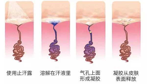 夏天腋窝出汗小神器,夏天腋窝出汗多用止汗露