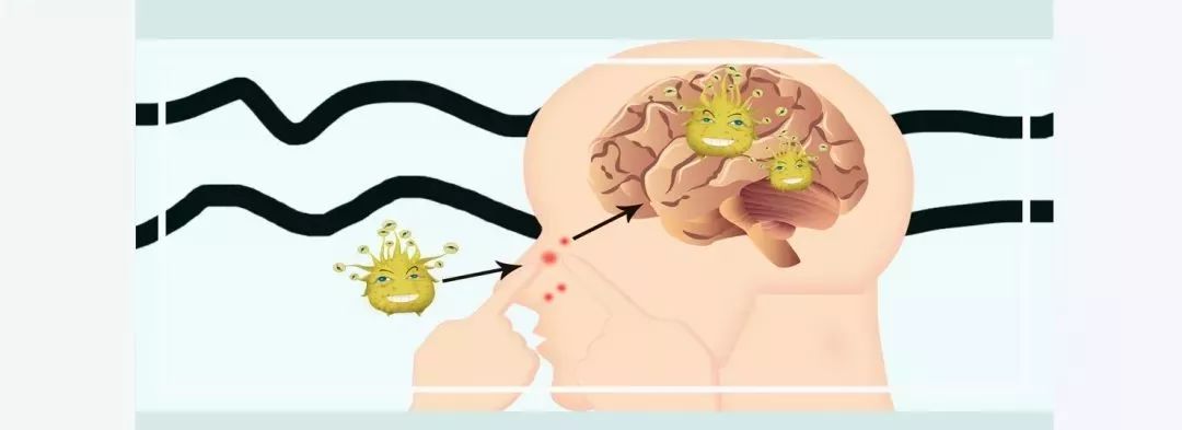 三角区的痘痘千万不要碰,三角区祛痘科普