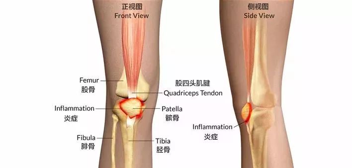 护膝运动真的能保护膝盖吗,登山护膝如何保护膝盖