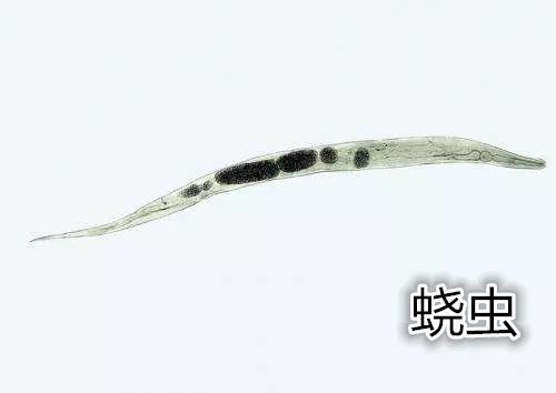 4岁女童屁屁痒,妈妈脱下裤子检查后吓坏了!一粒粒竟还会动...