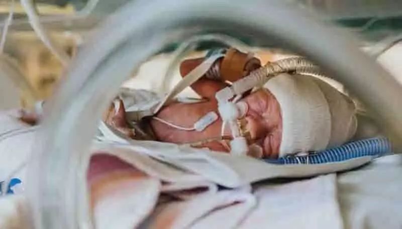 心疼！出生2天早产儿腹胀如包子生命垂危，医生打开腹部一看吓坏了