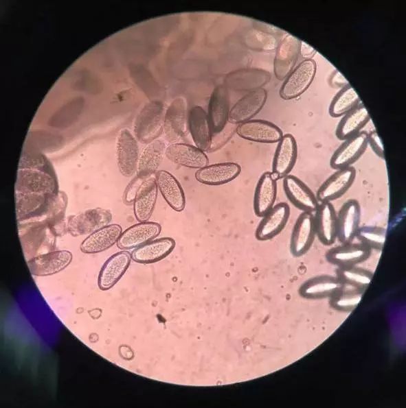 宝宝夜晚哭闹打虫,夜里宝宝屁股里爬出小白虫