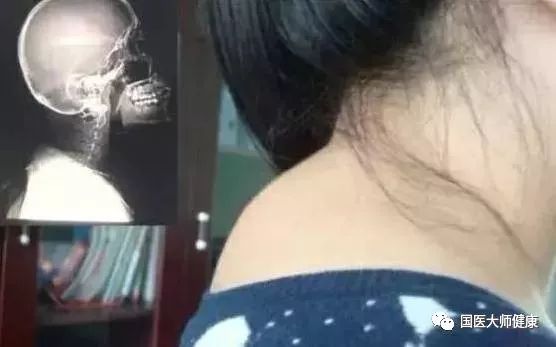 紧急提醒已进入高发期,紧急提示后市需要留意什么